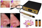 Dm-9055 Laser Capillaries Broken Machine Spider Treatment Dm9055 Professional Vein