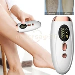 Ipl Hair Removal Laser Permanent Body Epilator Painless Device 999,999 Flashes. Fixed Price $24.99.
