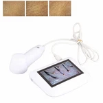 Skin Diagnosis Hair Analyzer, 5 Inch Lcd Screen Digital Detector Tester. Fixed Price $219.13.